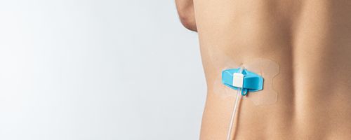 Case Study binnen de medische sector | Mavom