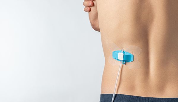 Case Study binnen de medische sector | Mavom